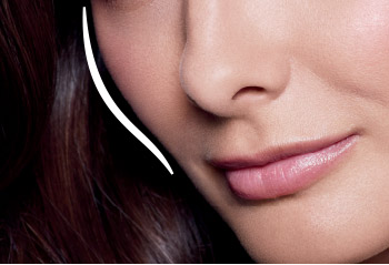 Juvederm Facial Filler